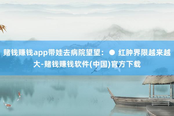 赌钱赚钱app带娃去病院望望：● 红肿界限越来越大-赌钱赚钱软件(中国)官方下载